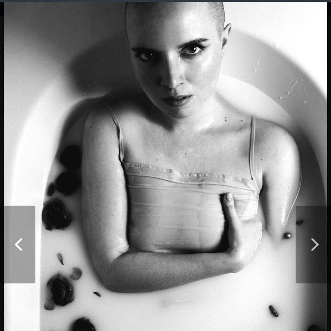 Довго лікували не від того: Яніна Соколова розповіла, як дізналася про рак