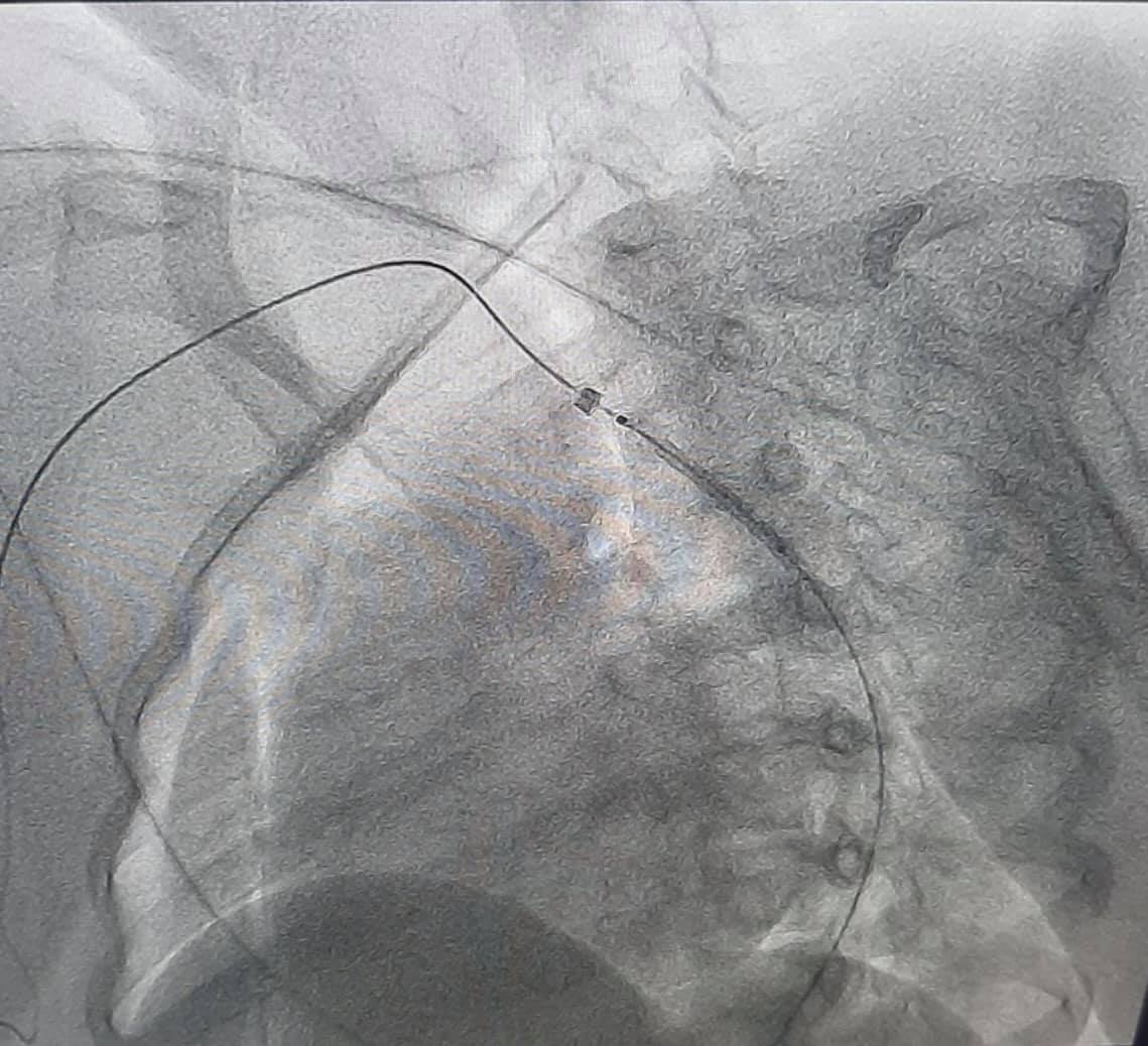 В Україні вперше провели операцію за допомогою віртуальної реальності