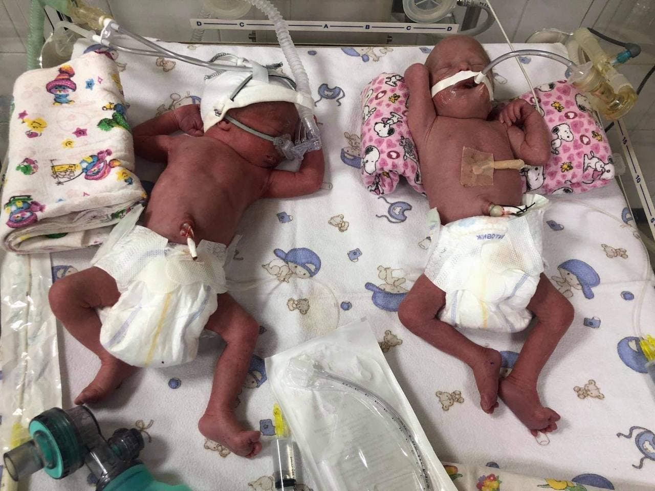 На Закарпатье 20-летняя женщина родила сразу четверых малышей