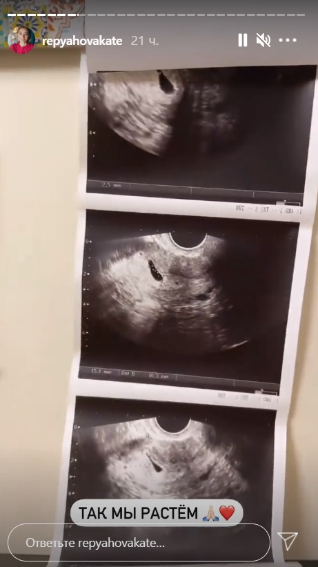 Вагітна дружина Віктора Павліка поділилася першим фото дитини