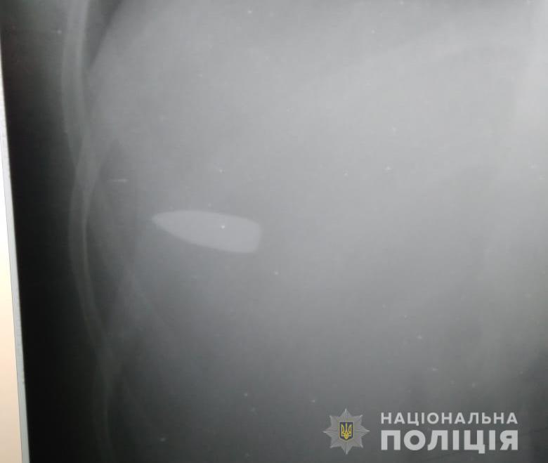 В Киевской области мужчина выстрелил из ружья и ранил женщину