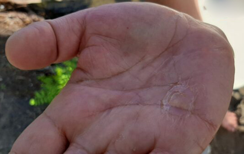 В Киеве бьют тревогу из-за аномального нашествия медуз: в чем причина