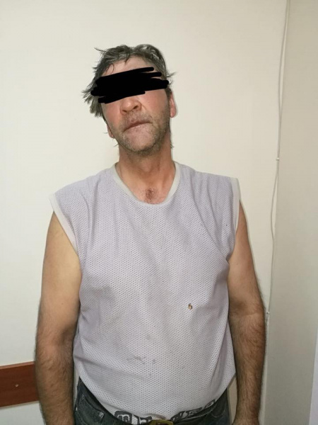 В Одессе ребенка облили кислотой