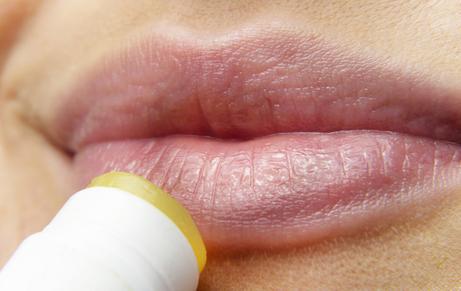 Топ-4 совета, которые помогут избавиться от сухости губ