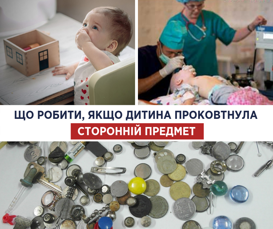 Что делать, если дети проглотили посторонний предмет: Супрун дала ответ