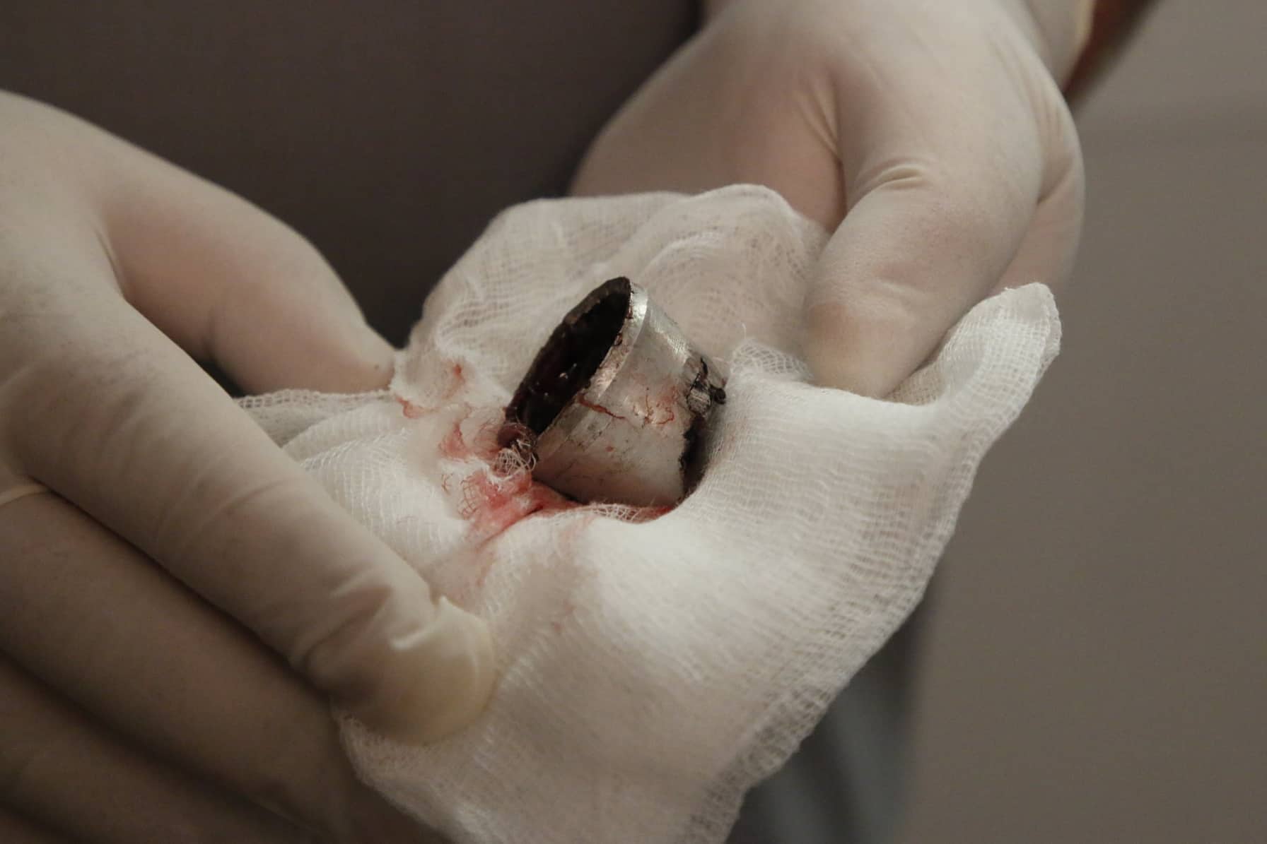 Вибух на дитячому майданчику під Дніпром: нові деталі та відео