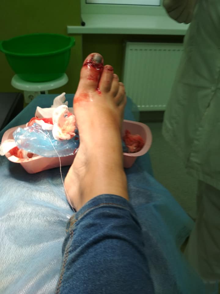 В киевском аэропорту на ребенка упал шкаф: подробности инцидента (фото, видео)