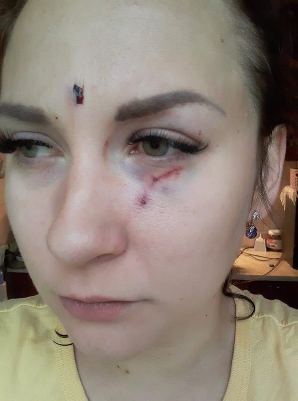 В Николаеве таксист изувечил пассажирку, которая забыла кошелек (фото)