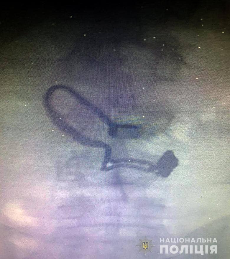 Дайте ему слабительного: в сети обсуждают вора, проглотившего цепочку потерпевшей