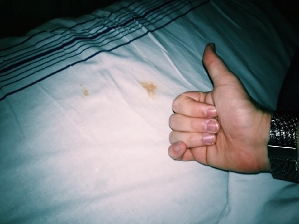 Это кровь или соус? Укрзализныця влипла в двойной скандал