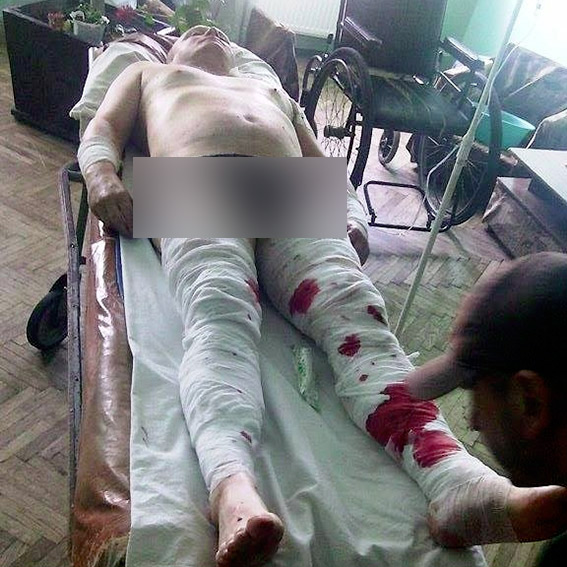 Взрыв в Ивано-Франковской области: совершено покушение на чиновника РГА