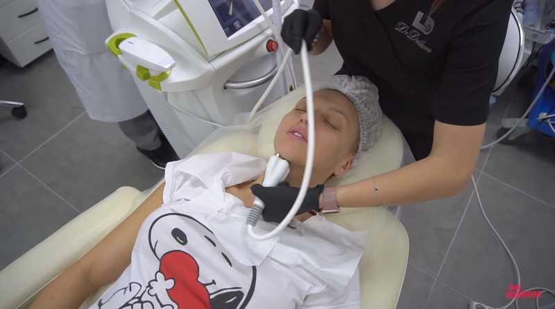 "Колю ботокс": Оля Полякова откровенно рассказала о своих бьюти-процедурах