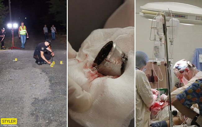 Взрыв на детской площадке под Днепром: появилась новая информация о покалеченных детях