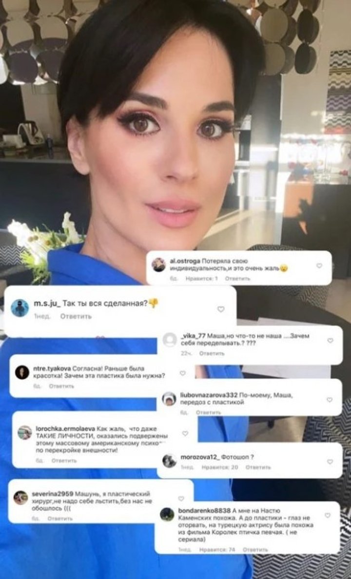 Маша Єфросиніна відповіла на звинувачення в пластиці і показала свого "хірурга"