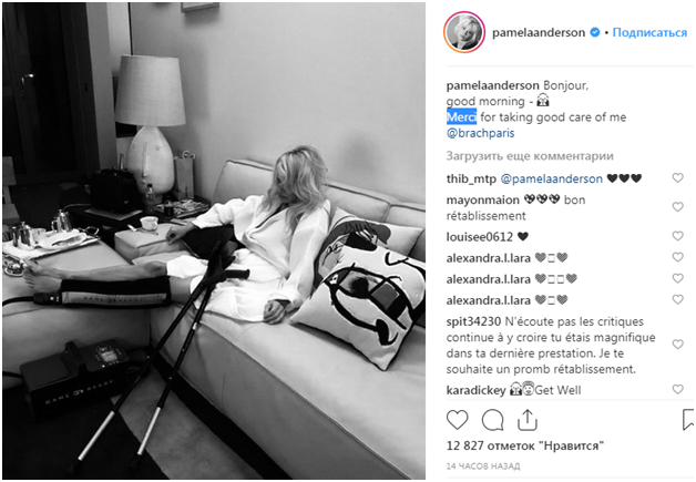 В бандаже и с костылями: Памела Андерсон испугала своих фанатов