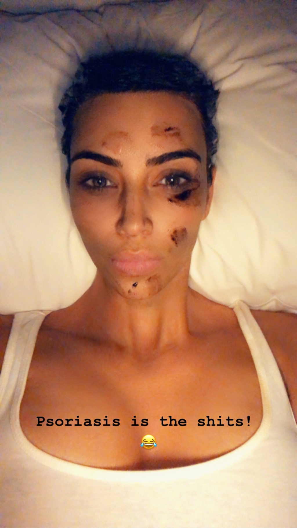 Смелая и откровенная: Ким Кардашьян не побоялась показать недостатки кожи (фото)