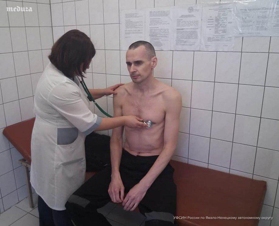 Появилось фото обследования Сенцова в российской больнице