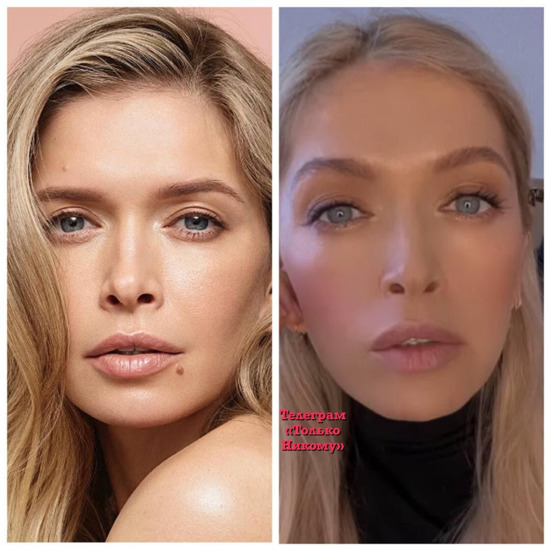 Віра Брежнєва змінила свою зовнішність: позбулася "особливості"