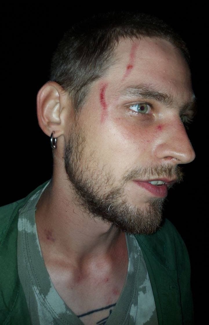 В Беларуси силовики пытали задержанного украинца. МИД отреагировал