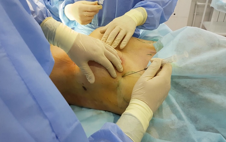 Современные способы увеличения груди и надо ли рисковать?