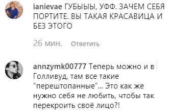 Пора в музей восковых фигур: Ани Лорак заподозрили в операции на лице
