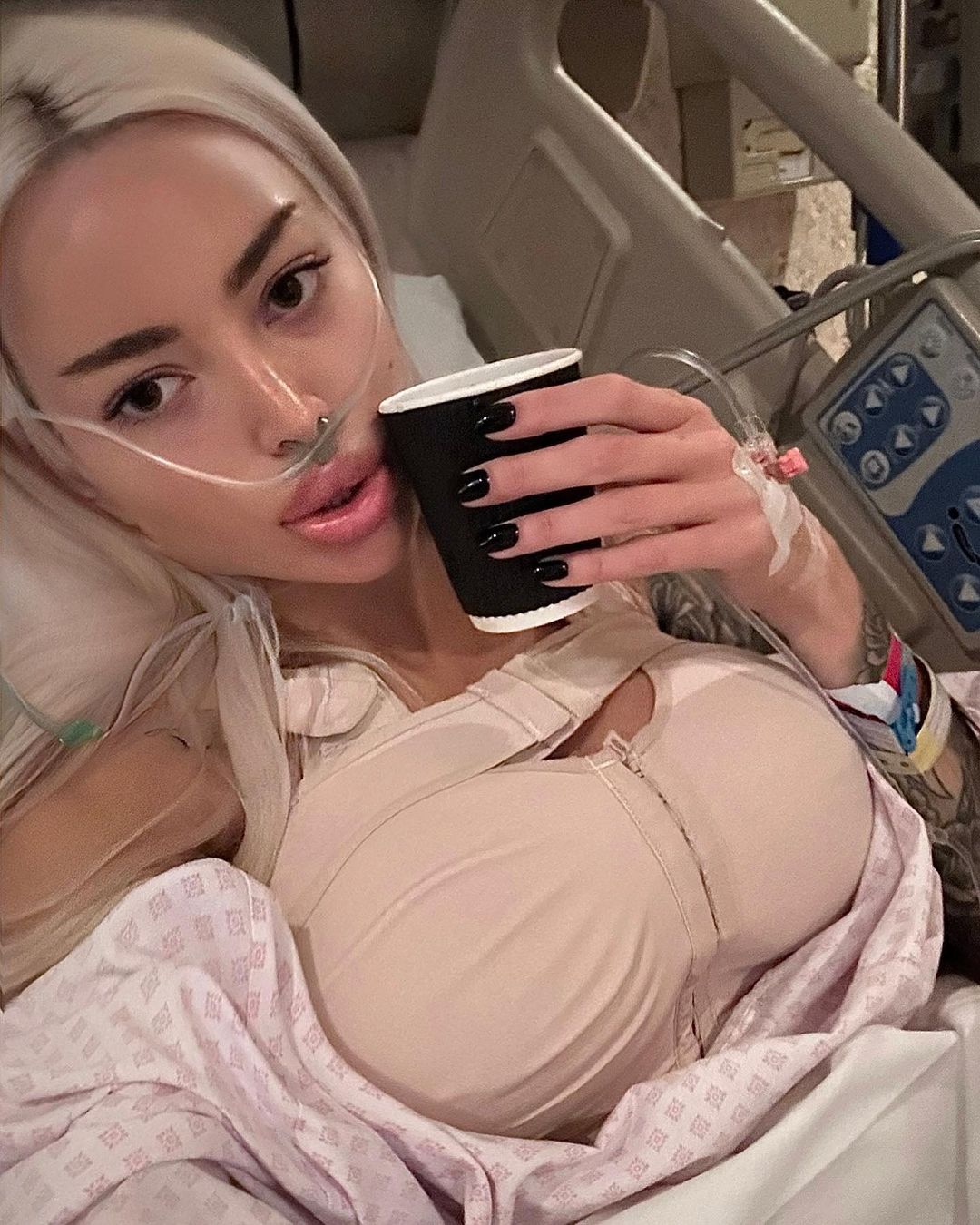 Погляньте, що сталося з "українською Кардаш'ян": знову лягла під ніж і тепер спокушає іноземців