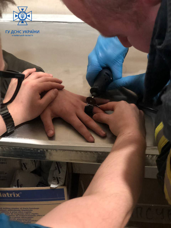 Під Києвом хлопець не міг зняти кільце від ліхтарика з пальця: відео порятунку