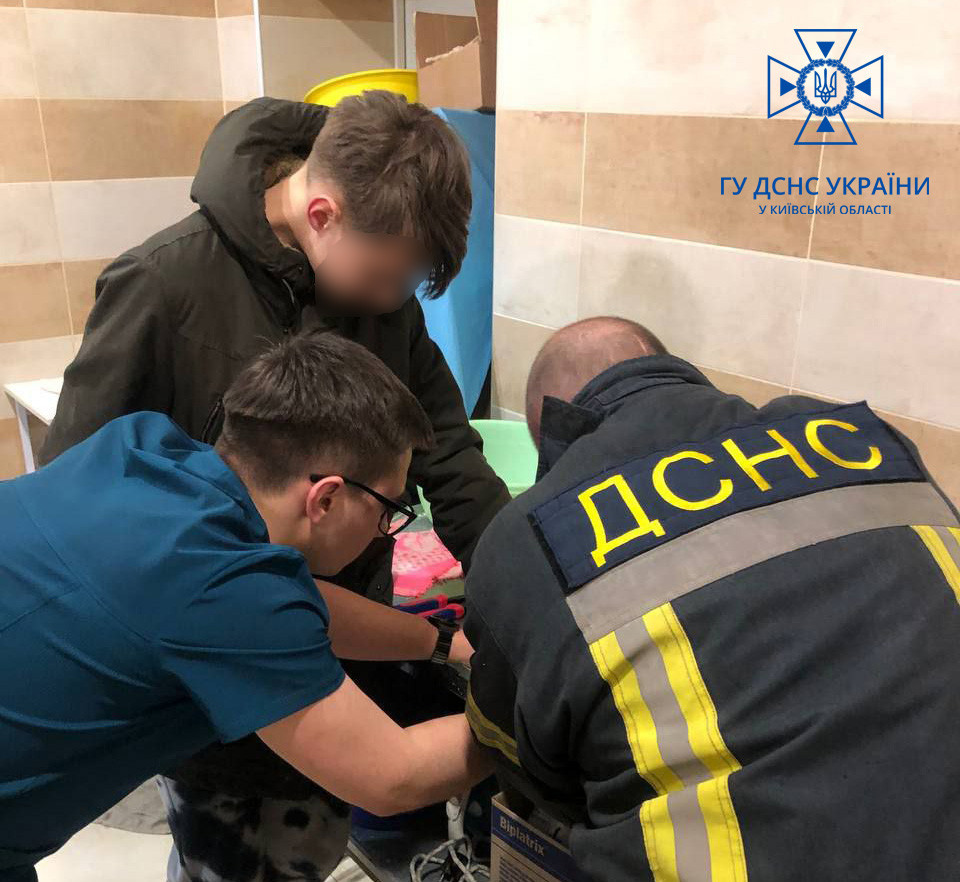 Під Києвом хлопець не міг зняти кільце від ліхтарика з пальця: відео порятунку