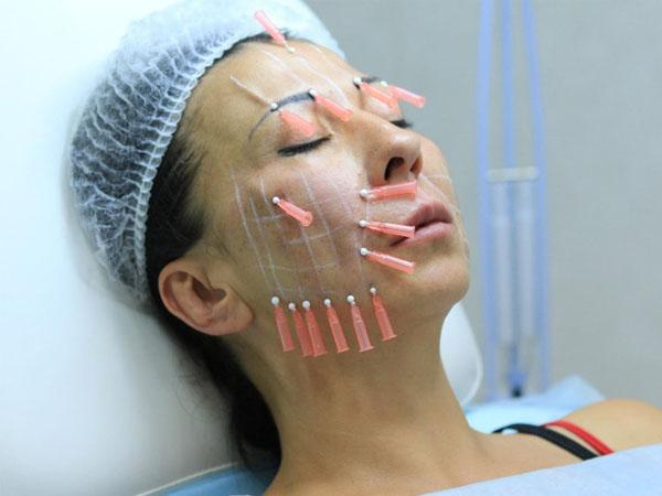 Попередження для українок: топ-5 косметичних процедур, яких треба уникати