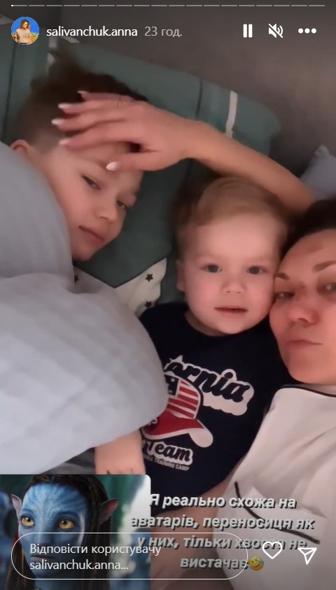 Зірка "Квартала 95" Саліванчук жахнула фото після перелому носа і струсу мозку