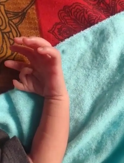 Дівчинка народилася на світ із 26 пальцями: батьки вважають це божественним (фото)