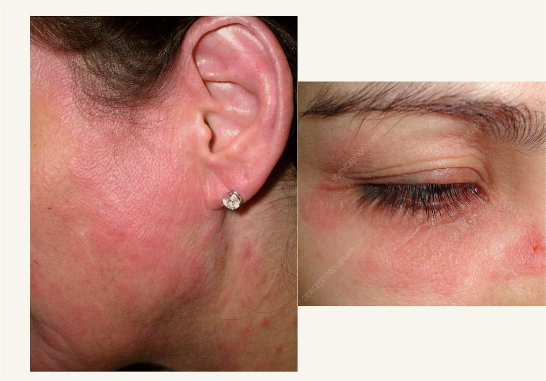 Дерматолог показала, що може статись з обличчям після нанесення косметики