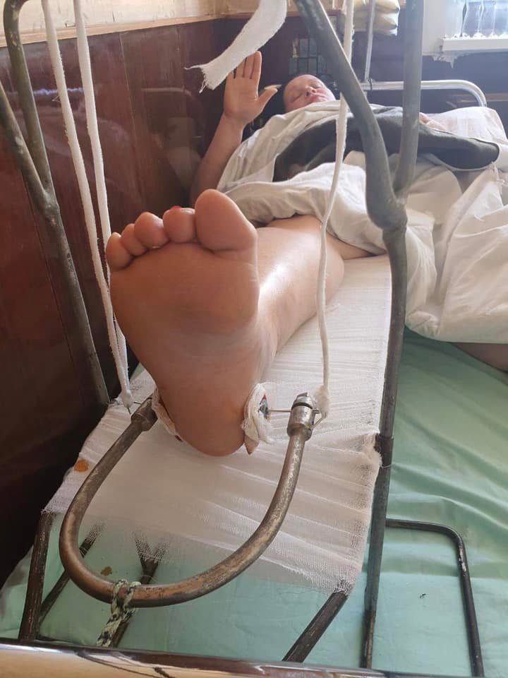 Двигаться почти не могу: Руслана Писанка рассказала о своем состоянии после падения на сцене