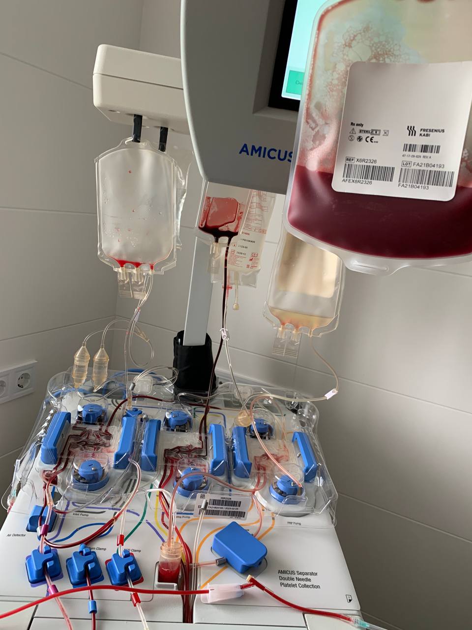 Львовские врачи раскрыли детали первой уникальной операции: "маленький герой совсем не боялся"