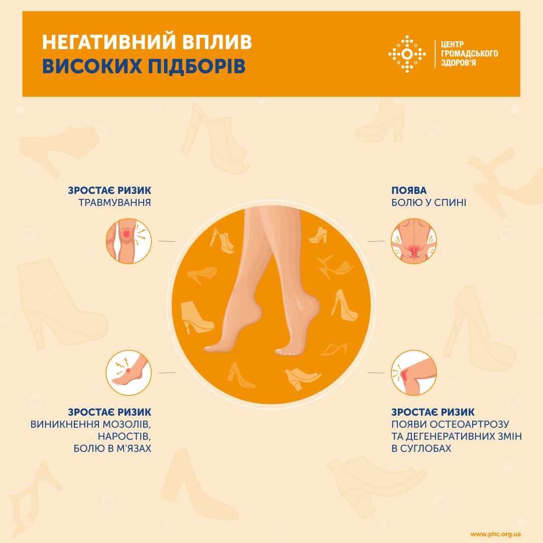 Підбори - це красиво, але дуже небезпечно: чому не варто використовувати таке взуття щодня