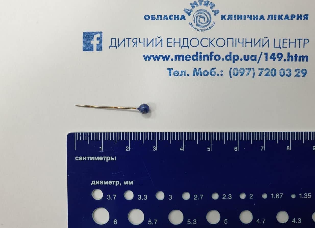 В Днепре ребенок проглотил булавку: врачи спасли необычным способом (фото)