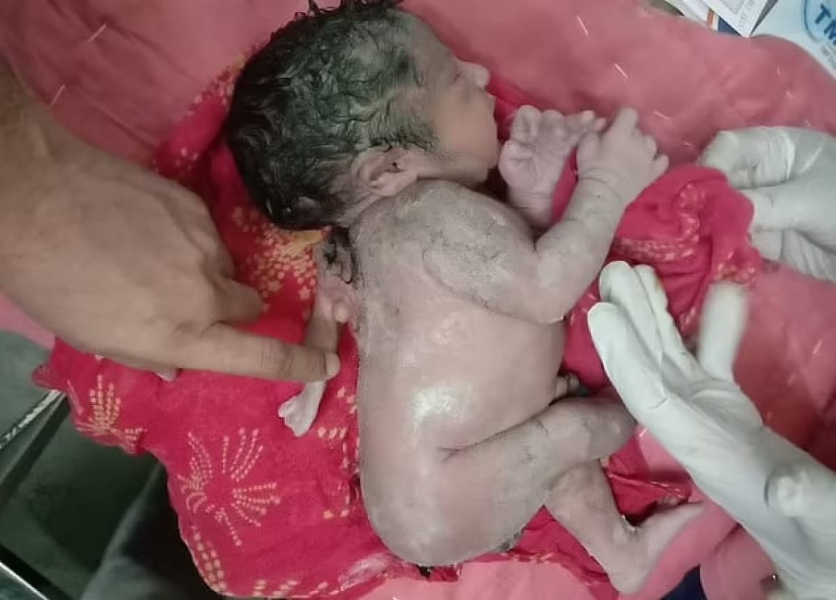 Дитина народилася з третьою рукою в неочікуваному місці (фото)