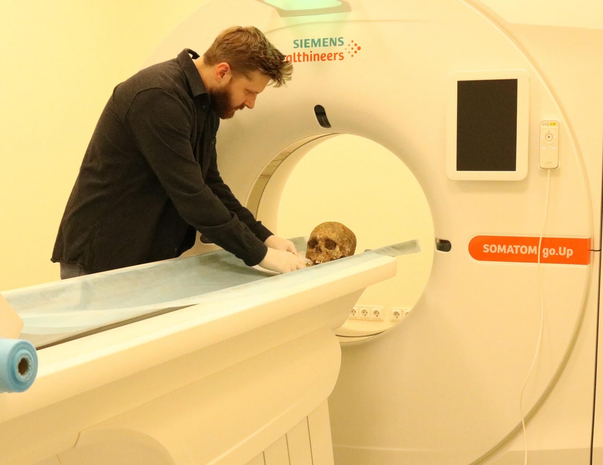 Лежали в могилі, обійнявшись: під Тернополем знайшли поховання, вік якого 3000 років (фото)