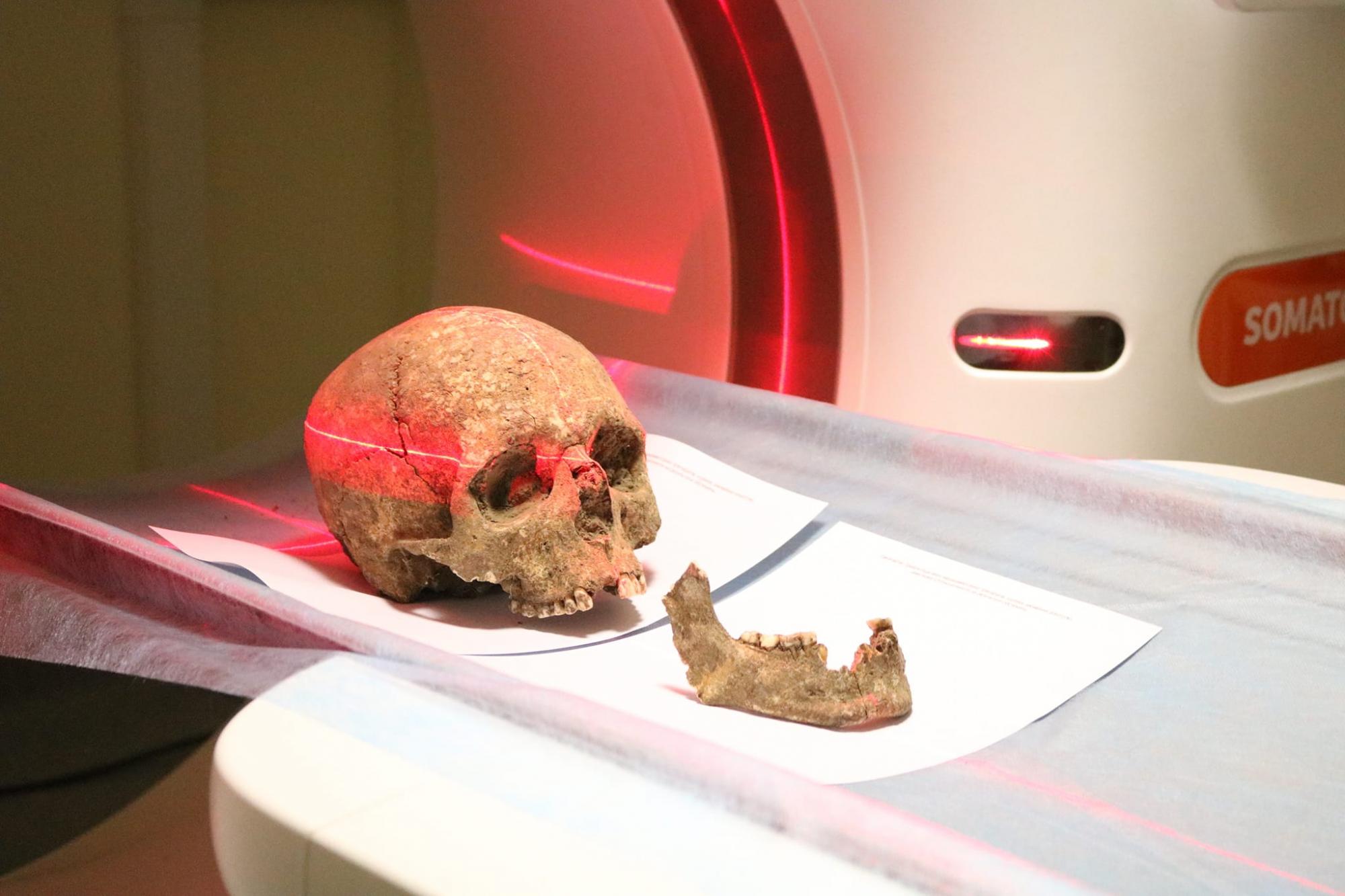 Лежали в могилі, обійнявшись: під Тернополем знайшли поховання, вік якого 3000 років (фото)