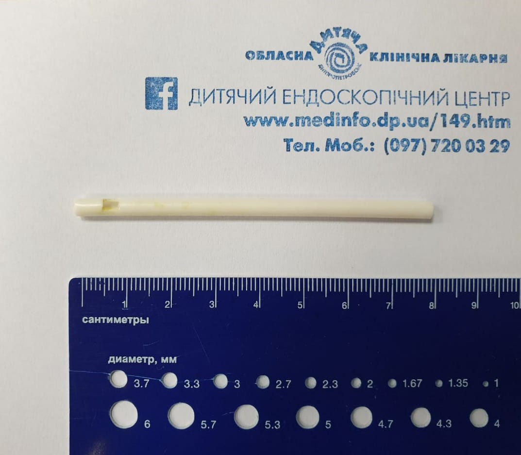 В Днепре ребенок съел палочку от Chupa Chups: была в теле 10 дней (фото)