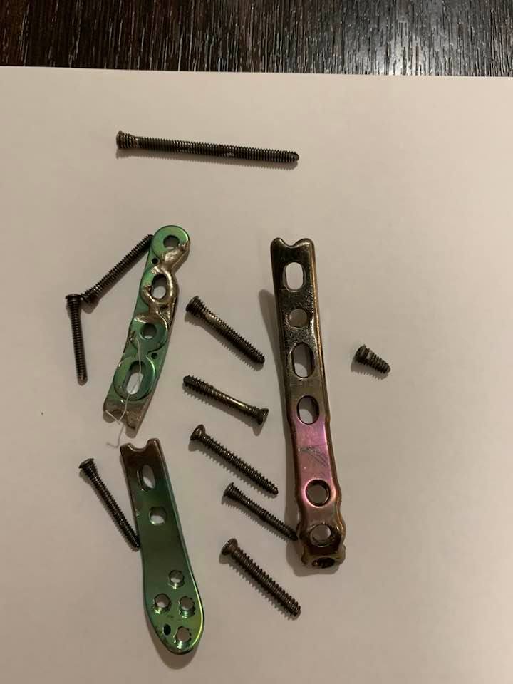 Дмитрию Ярошу провели хирургическую операцию в Днепре и спасли руку