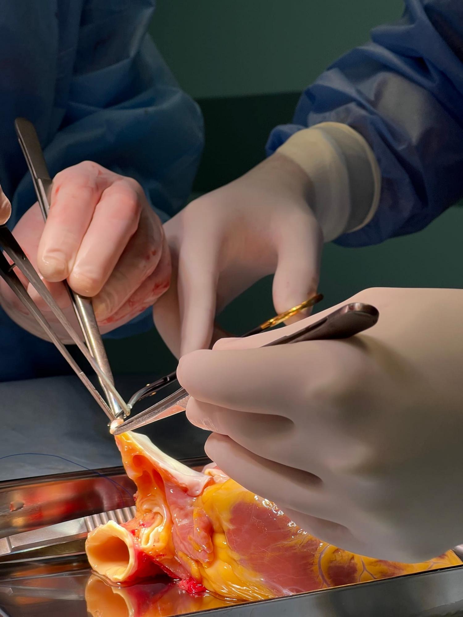 Украинские врачи за шесть дней пересадили семь органов: как прошли операции