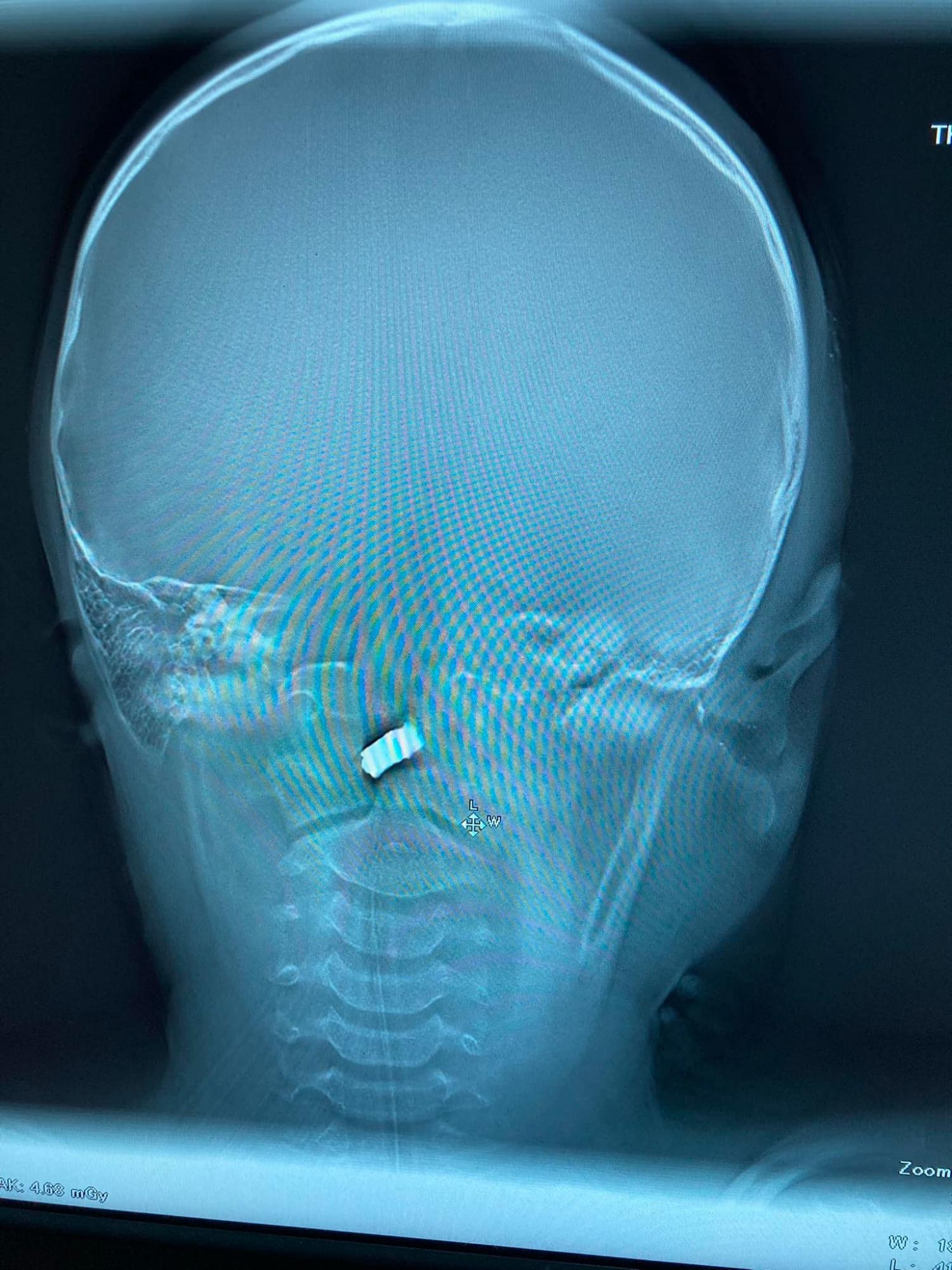 Що відбувається в Харкові зараз. Ситуація в місті 9 березня: онлайн