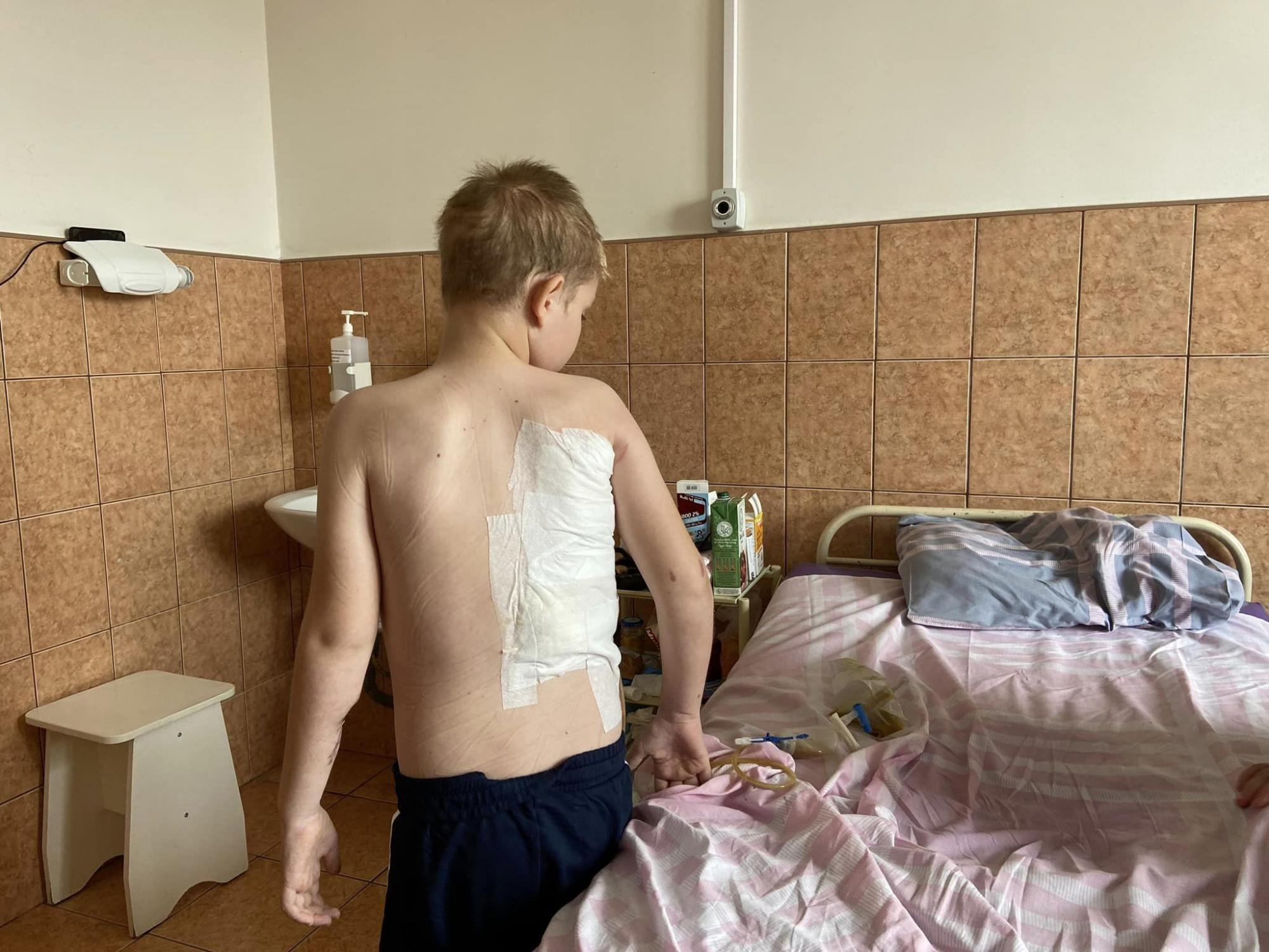 Львівські лікарі поставили на ноги 11-річного Артема з Харкова, який пережив кому і 8 операцій