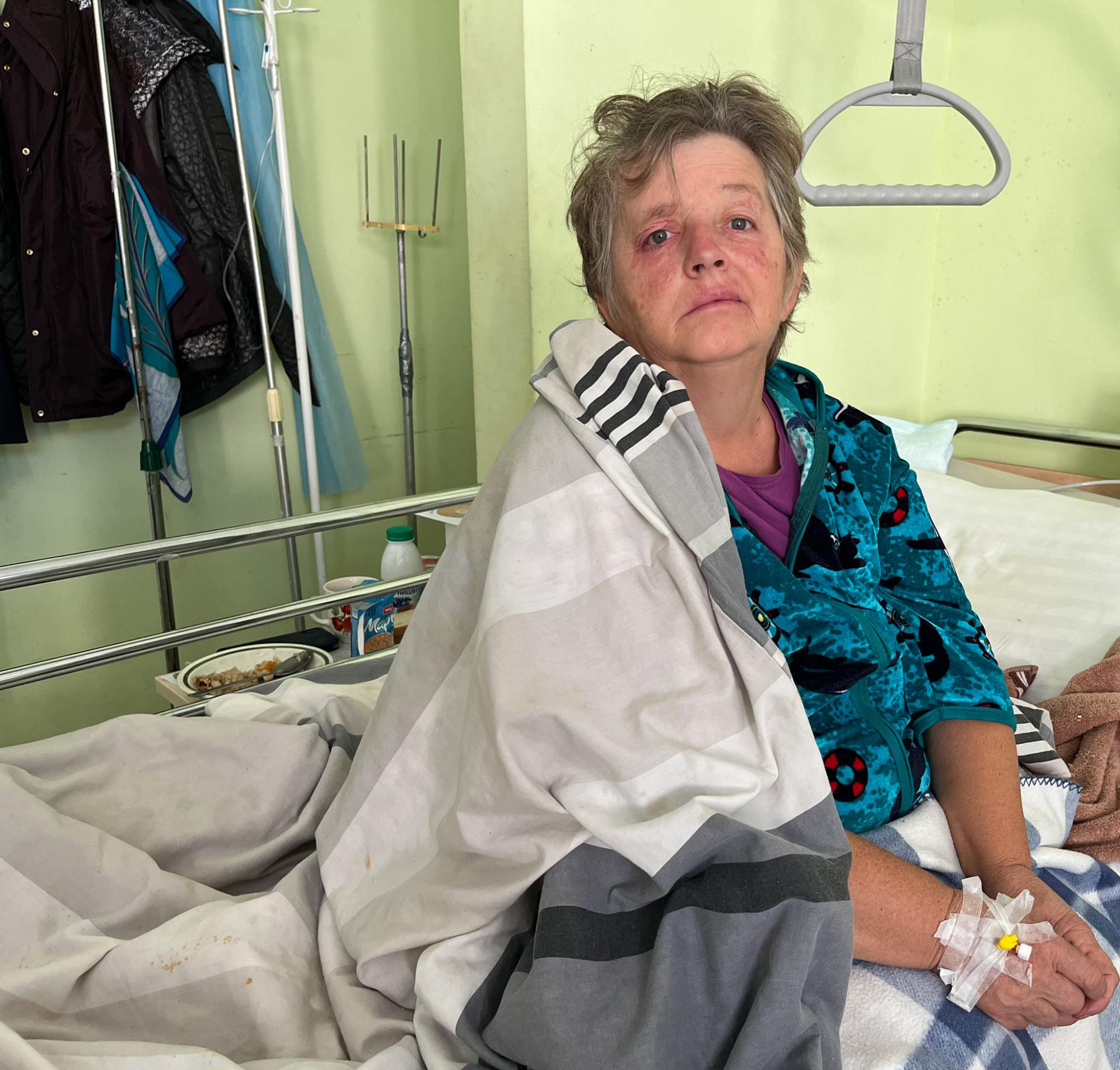 Ні одного розрізу: українські медики врятували життя жінці з величезною аневризмою