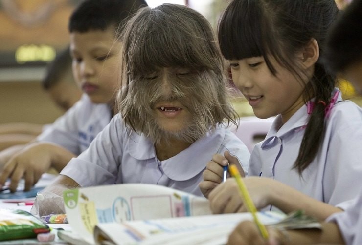 Від "дівчинки-вовчиці" до впевненої жінки: історія незвичайної рекордсменки книги Гіннеса