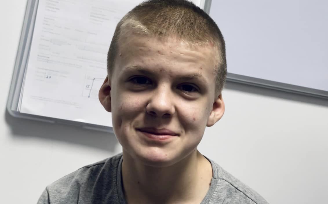 Во Львове запустили детское протезирование. Вот трогательные фото первого счастливого пациента