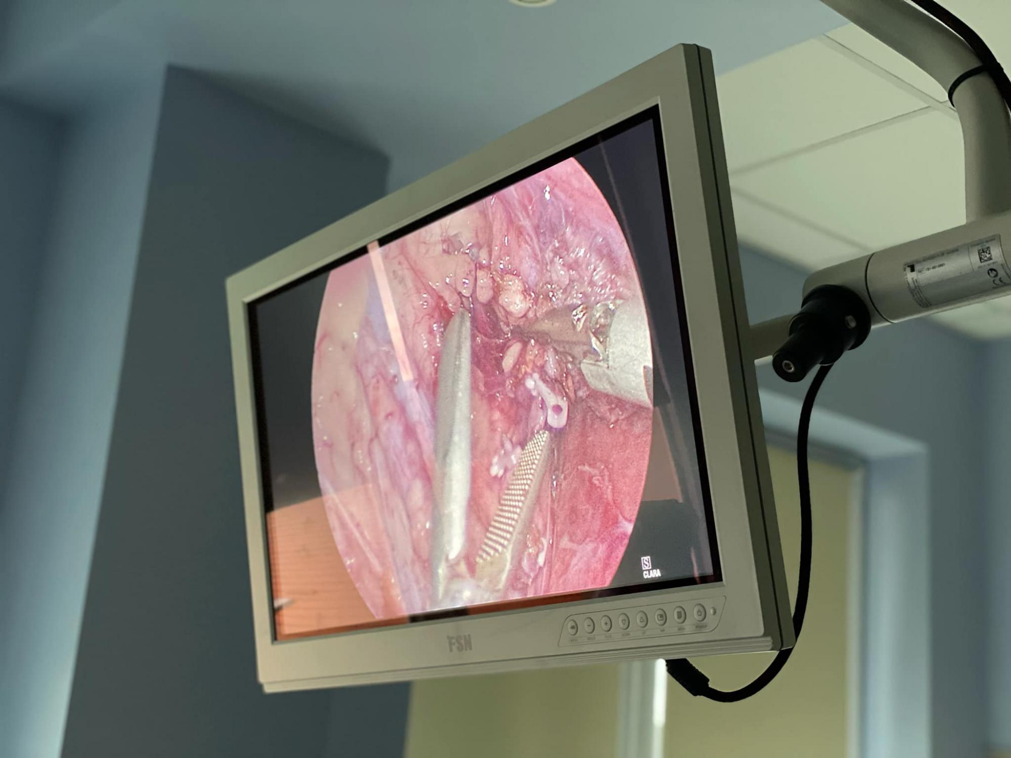 Українські лікарі унікальним способом врятували дитині життя: що вони зробили