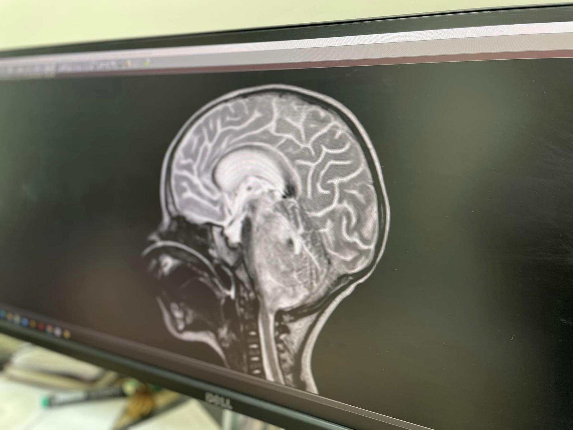 Операция во время обстреле и без света: во Львове в экстремальных условиях спасали ребенку жизнь