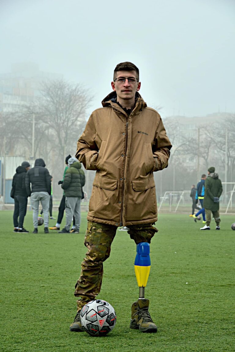 "Хочу бути на рівних". Військовий ЗСУ розповів про труднощі життя з протезом та реакцію оточення (фото)